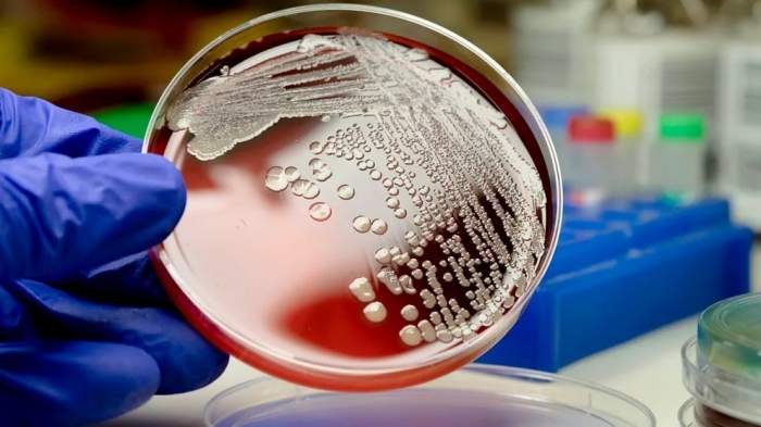 MENINGITIS: TIPOS MÁS GRAVES Y POR QUÉ HAY MÁS RIESGO EN PRIMAVERA